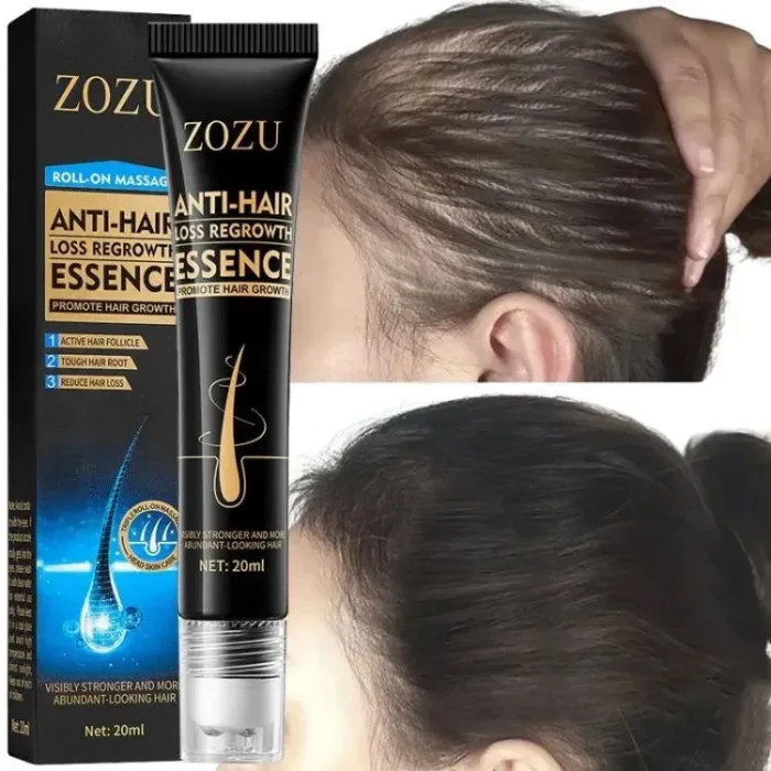 fast-hair-growth-essence-effective-anti-hair-loss-hair-care-serum-20ml