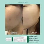axis-y-dark-spot-glow-serum